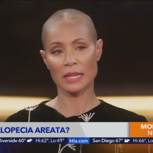 Jada Pinkett-Smith shares struggle with alopecia