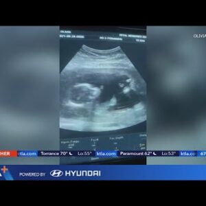 La Mirada woman to give birth after fearing she'd lost her child