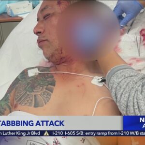 Man stabbed more than 10 times in Chinatown attack