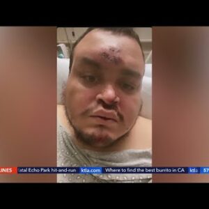 Suspected hate crime in Pasadena hospitalizes 3