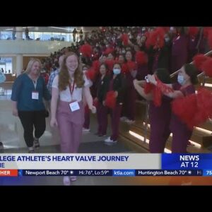 College athlete meets team who assembled heart valve she needed