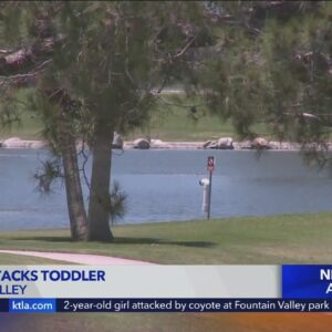 2-year-old girl attacked by coyote at Fountain Valley park