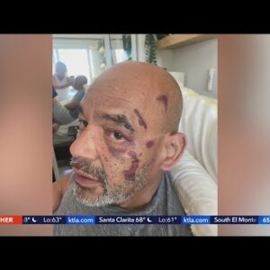 Family seeks justice after man beaten, robbed in Reseda parking lot
