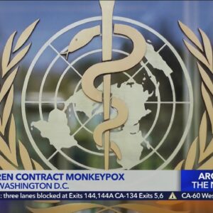 2 children, 1 in CA, diagnoses with monkeypox