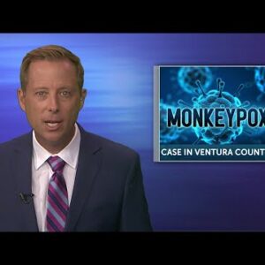 First Monkeypox case confirmed in Ventura County