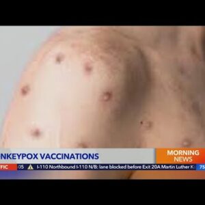 Pop-up clinic issues Monkeypox vaccine in Encino
