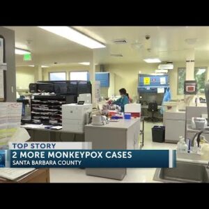 Santa Barbara County Public Health confirms two additional cases of Monkeypox
