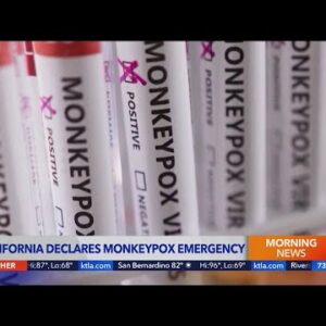 Local emergency declared in L.A. County for monkeypox