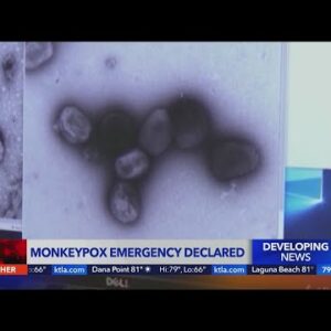 Local monkeypox emergency declared