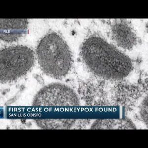 San Luis Obispo County Public Health confirms first case of Monkeypox