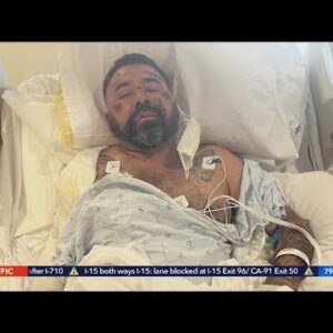 Scooter rider severely injured in hit-and-run crash