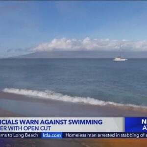 Visiting Hawaii? Don't swim in fresh water with an open cut