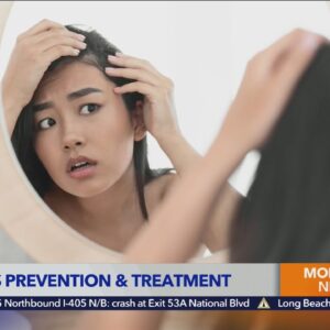 Hair transplant surgeon Dr. Craig Ziering on hair loss treatment for women