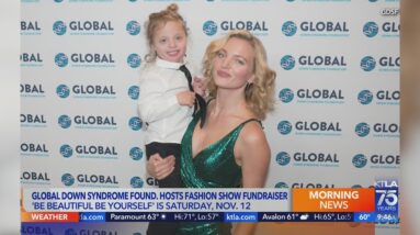 Model and Down Syndrome activist Amanda Booth previews 'Be Beautiful Be Yourself' Fashion Show