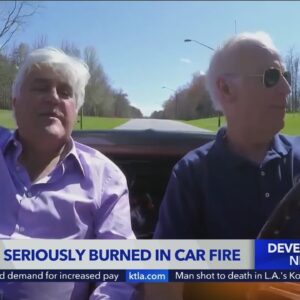 Jay Leno suffers serious burns in fire