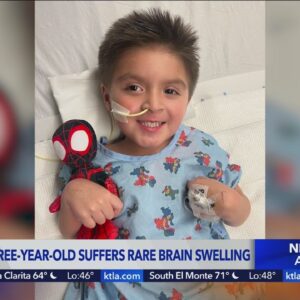 3-year-old hospitalized with rare brain swell after contracting COVID-19