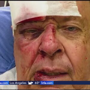 LAPD veteran volunteer recovering after being swarmed by bees in Encino