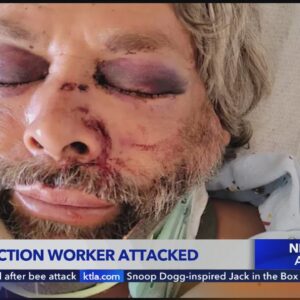 Construction worker brutally attacked on job in Garden Grove