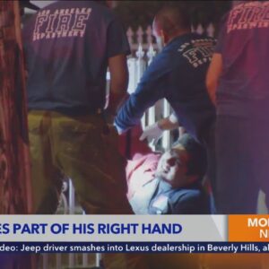 Man loses part of hand, house catches fire amid July 4 fireworks mishaps