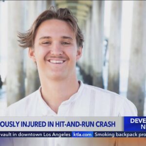 20-year-old Cal State Long Beach student severely injured in Fountain Valley hit-and-run