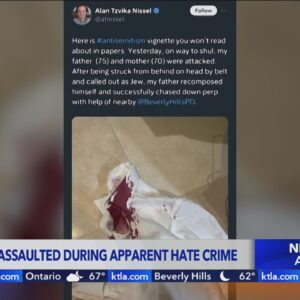 Jewish man attacked in apparent hate crime in Beverly Hills speaks out
