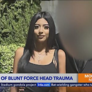 Los Angeles student died of ‘accidental’ blunt head trauma: examiner