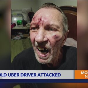 70-year-old Uber driver brutally beaten by passenger in Los Angeles 