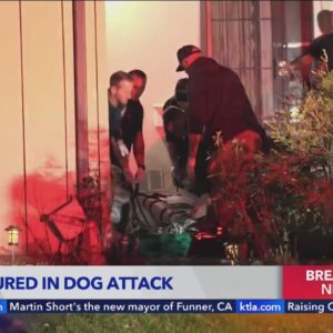 Four hurt, including child, in Van Nuys dog attack
