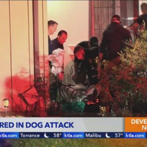 Two hospitalized in Southern California dog attack