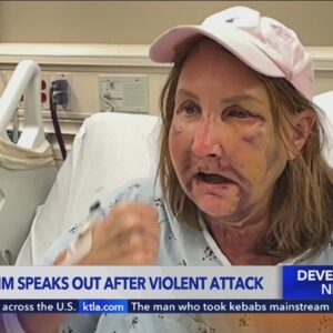 Woman recalls being nearly beaten to death by Venice canal attacker