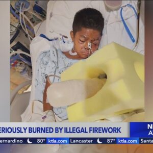 Orange County boy hospitalized, loses fingers after finding illegal firework