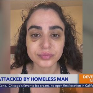 Homeless man's attack on woman in Beverly Grove 'completely unprovoked,' she says