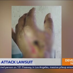 South L.A. woman wants end to K-9 units after vicious attack