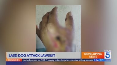 South L.A. woman wants end to K-9 units after vicious attack