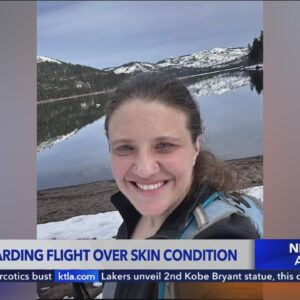 Woman said she was removed from Burbank flight over rare medical condition