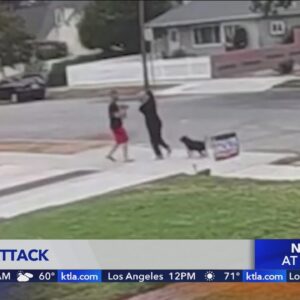 Pomona couple attacked by pit bull