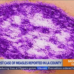 Person who arrived from China with measles visited Los Angeles area nail salon, grocery store: offic